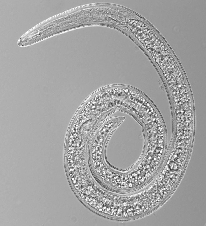 Photograph of a nematode (under microscope; ×100) indicating the three